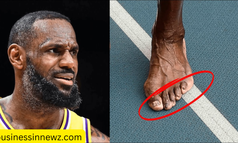 lebron james feet